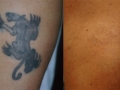 chest-tattoo-BA