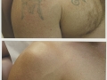 shoulder1